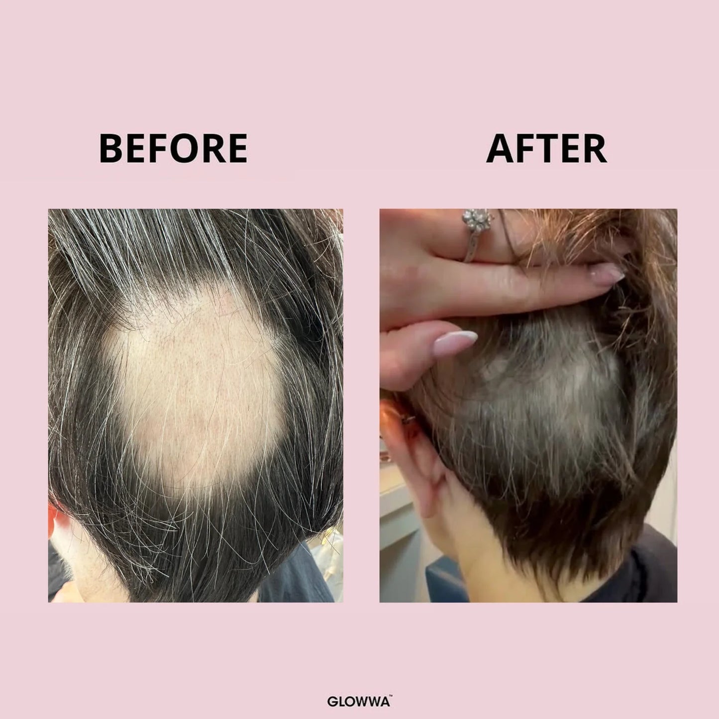 Glowwa Hair Food | Men's