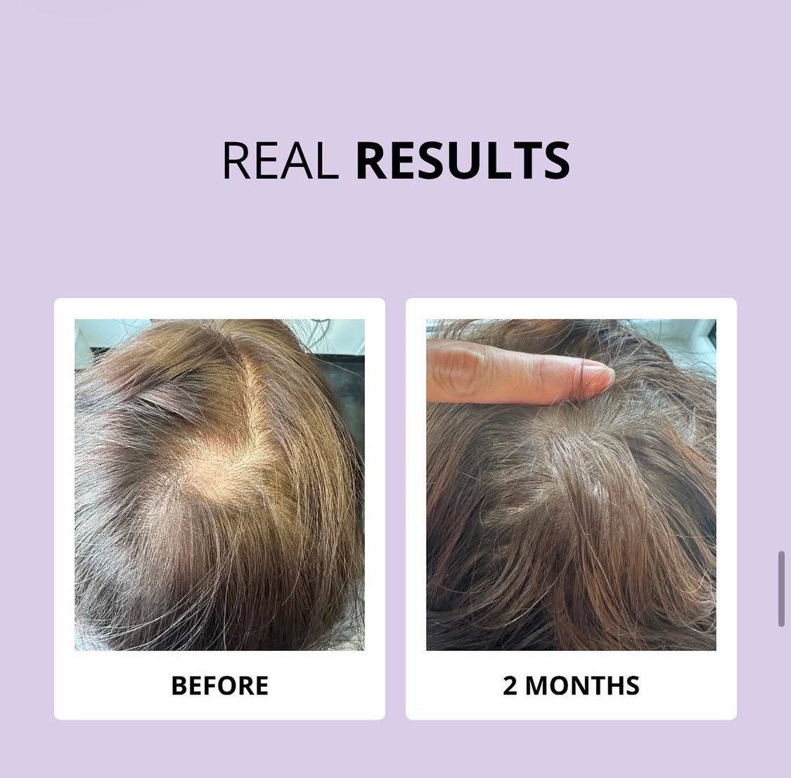 Glowwa Hair Food | Meno 3 Month Supply