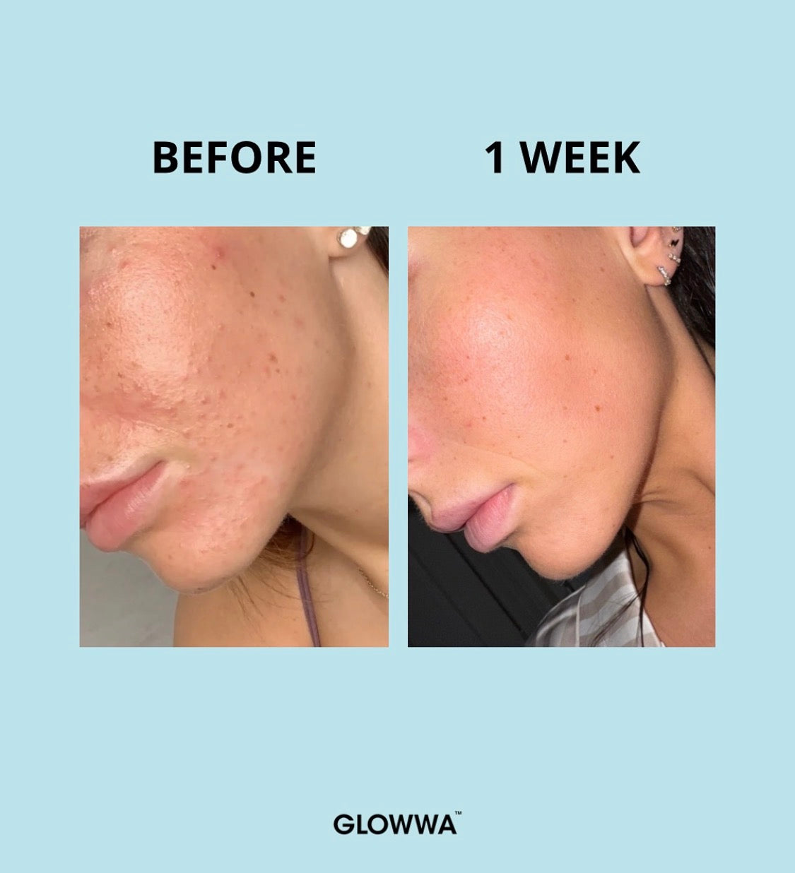 Glowwa Collagen