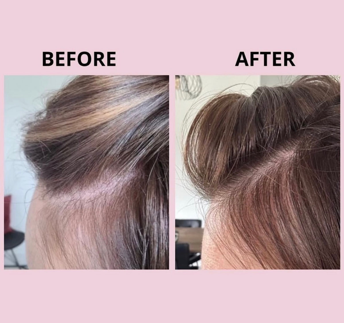 Glowwa Hair Food