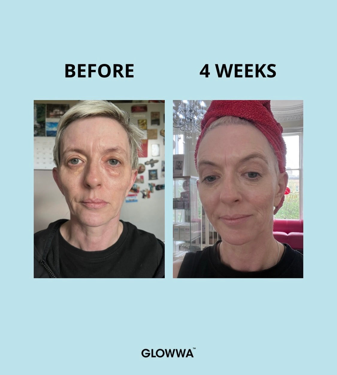 Glowwa Collagen
