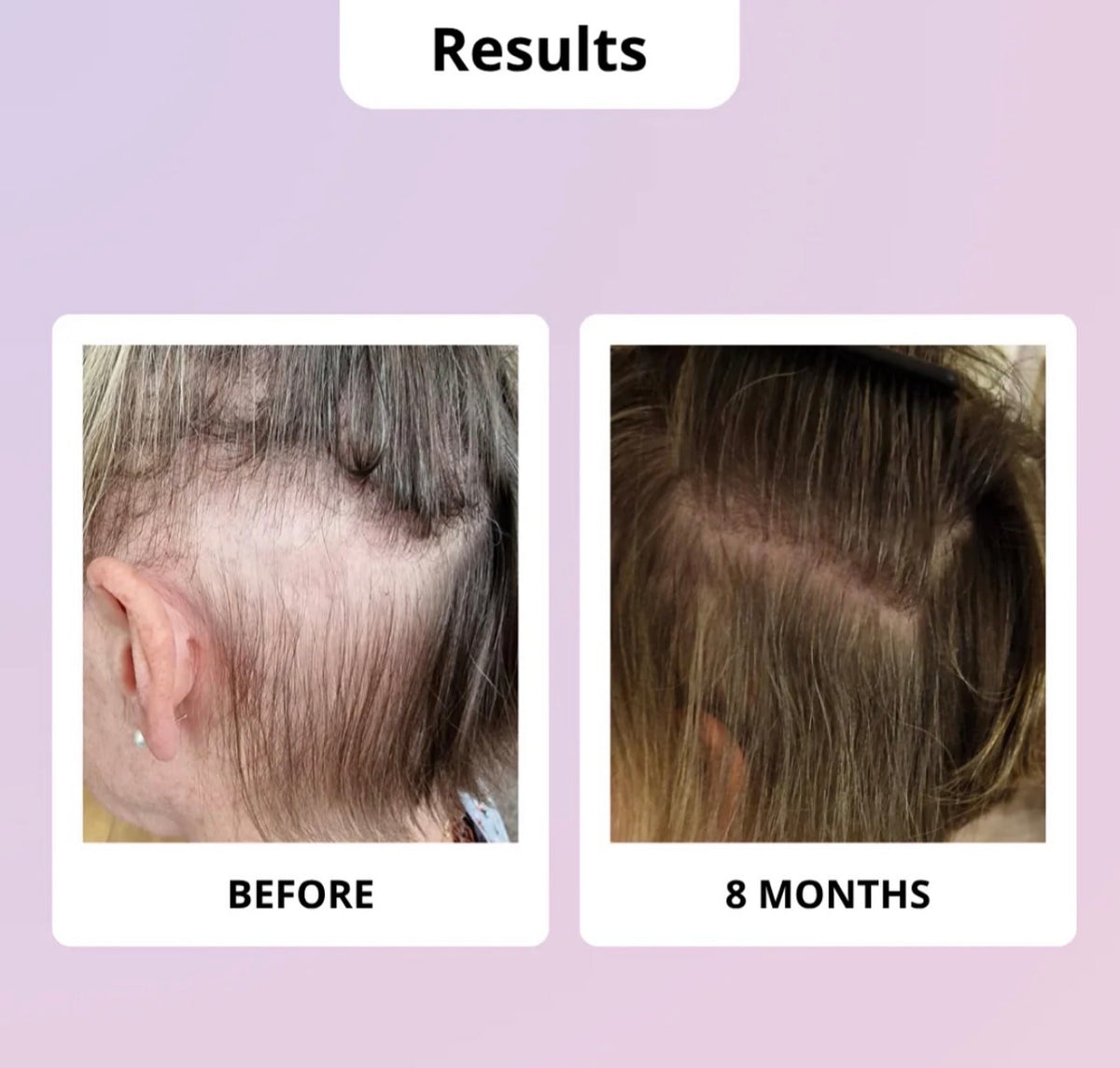 Glowwa Hair Food | Meno 3 Month Supply