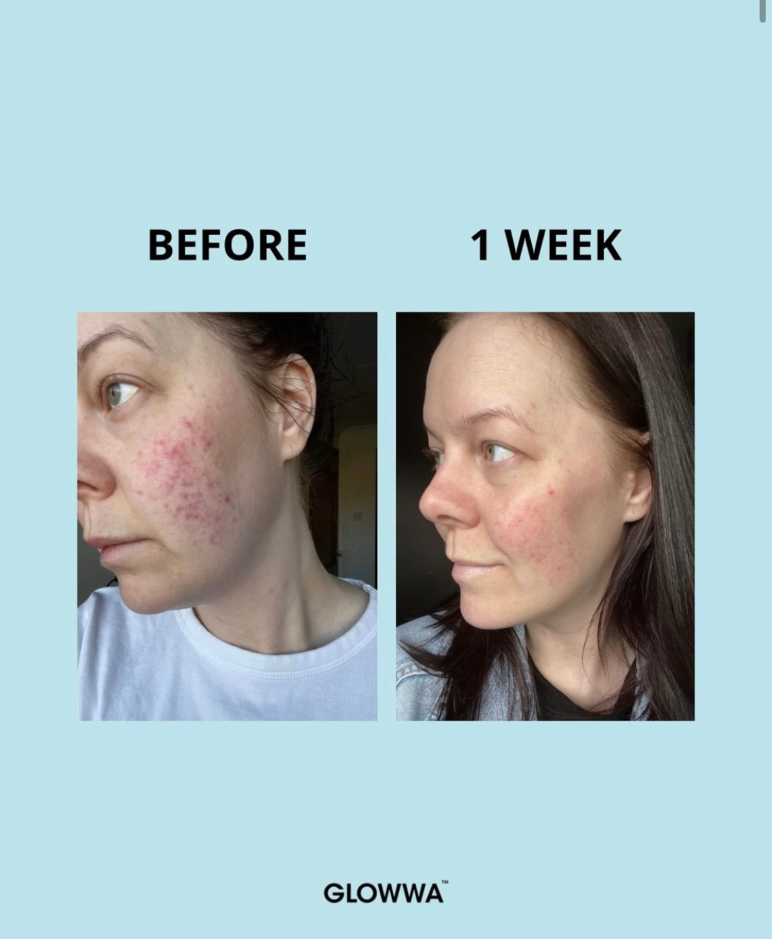 Glowwa Collagen